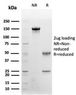 CD48 (Pan Leukocyte Marker) Antibody in Immunoelectrophoresis (IE)