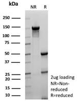KLK4/Kallikrein related peptidase 4 Antibody in SDS-PAGE (SDS-PAGE)