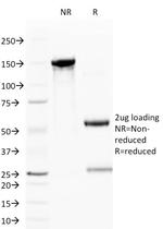 CD59/Complement Regulatory Protein/Protectin Antibody in SDS-PAGE (SDS-PAGE)