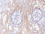 CD59/Complement Regulatory Protein/Protectin Antibody in Immunohistochemistry (Paraffin) (IHC (P))