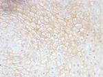 CD59/Complement Regulatory Protein/Protectin Antibody in Immunohistochemistry (Paraffin) (IHC (P))