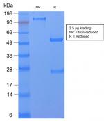 CD59/Complement Regulatory Protein/Protectin Antibody in SDS-PAGE (SDS-PAGE)