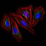 CD63 (Late Endosomes Marker) Antibody in Immunocytochemistry (ICC/IF)