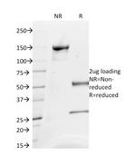 CD63 (Late Endosomes Marker) Antibody in SDS-PAGE (SDS-PAGE)
