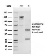 CD63 (Late Endosomes Marker) Antibody in SDS-PAGE (SDS-PAGE)