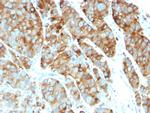 CD63 (Late Endosomes Marker) Monoclonal Antibody (LAMP3/968)