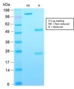 CD63 Antibody in SDS-PAGE (SDS-PAGE)
