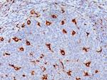 CD68 (Macrophage Marker) Monoclonal Antibody (KP1)