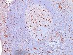 CD68 (Macrophage Marker) Antibody in Immunohistochemistry (Paraffin) (IHC (P))
