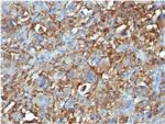 CD68 Antibody in Immunohistochemistry (Paraffin) (IHC (P))
