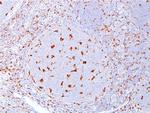 CD68 Antibody in Immunohistochemistry (Paraffin) (IHC (P))
