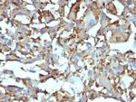 CD68 (Macrophage Marker) Antibody in Immunohistochemistry (Paraffin) (IHC (P))