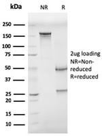 CD68 (Macrophage Marker) Antibody in SDS-PAGE (SDS-PAGE)