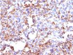 CD68 (Macrophage Marker) Antibody in Immunohistochemistry (Paraffin) (IHC (P))