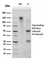 CD68 (Macrophage Marker) Antibody in SDS-PAGE (SDS-PAGE)