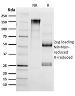 CD68 (Macrophage Marker) Antibody in SDS-PAGE (SDS-PAGE)