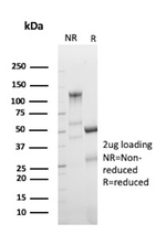 CD70/TNFSF7 (Activated T- & B-Lymphocyte Marker) Antibody in SDS-PAGE (SDS-PAGE)