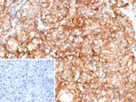 CD70/TNFSF7 (Activated T- & B-Lymphocyte Marker) Recombinant Rabbit Monoclonal Antibody (CD70/12768R)