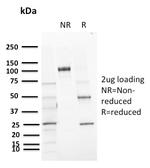 CD72 (B Cell Marker) Antibody in SDS-PAGE (SDS-PAGE)