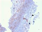 CD72 (B Cell Marker) Antibody in Immunohistochemistry (Paraffin) (IHC (P))