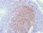 CD72 (B Cell Marker) Monoclonal Antibody (BU40)