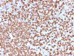 CD74 (B-Cell Marker) Antibody in Immunohistochemistry (Paraffin) (IHC (P))