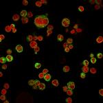 CD74 (B-Cell Marker) Monoclonal Antibody (LN-2)