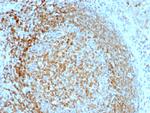 CD74 (B-Cell Marker) Antibody in Immunohistochemistry (Paraffin) (IHC (P))