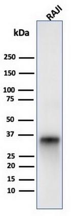 CD74 (B-Cell Marker) Antibody in Western Blot (WB)