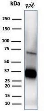 CD74 (B-Cell Marker) (Transcription Regulator) Antibody in Western Blot (WB)