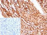 CD74 (B-Cell Marker) (Transcription Regulator) Antibody in Immunohistochemistry (Paraffin) (IHC (P))
