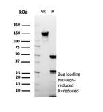 CD74 (B-Cell Marker) (Transcription Regulator) Antibody in SDS-PAGE (SDS-PAGE)