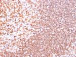CD74 (B-Cell Marker) Antibody in Immunohistochemistry (Paraffin) (IHC (P))