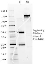 CD74 (B-Cell Marker) Antibody in SDS-PAGE (SDS-PAGE)