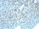 CD74 (B-Cell Marker) (Transcription Regulator) Monoclonal Antibody (CLIP/7946)