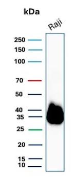 CD74 (B-Cell Marker) (Transcription Regulator) Antibody in Western Blot (WB)