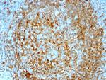 CD74 (B-Cell Marker) Antibody in Immunohistochemistry (Paraffin) (IHC (P))