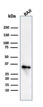 CD74 (B-Cell Marker) Antibody in Western Blot (WB)