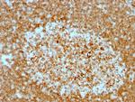 CD74 (B-Cell Marker) Antibody in Immunohistochemistry (Paraffin) (IHC (P))