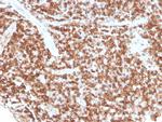 CD74 Recombinant Mouse Monoclonal Antibody (rCLIP, 813)