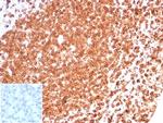 CD74 (B-Cell Marker) (Transcription Regulator) Antibody in Immunohistochemistry (Paraffin) (IHC (P))