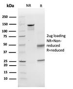CD74 (B-Cell Marker) (Transcription Regulator) Antibody in SDS-PAGE (SDS-PAGE)