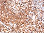 CD74 (B-Cell Marker) (Transcription Regulator) Monoclonal Antibody (CLIP/6609)