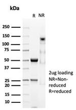 CD74 (B-Cell Marker) Recombinant Rabbit Monoclonal Antibody (CLIP/7023R)