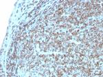 CD74 Recombinant Rabbit Monoclonal Antibody (CLIP, 3127R)