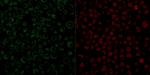 CD79a (B-Cell Marker) Monoclonal Antibody (JCB117)
