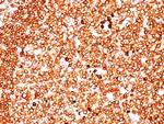CD79a (B-Cell Marker) Antibody in Immunohistochemistry (Paraffin) (IHC (P))