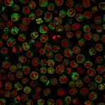 CD79a (B-Cell Marker) Monoclonal Antibody (HM47/A9)