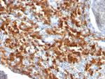 CD79a (B-Cell Marker) Antibody in Immunohistochemistry (Paraffin) (IHC (P))