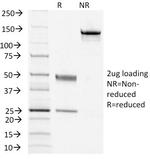 CD79a (B-Cell Marker) Antibody in SDS-PAGE (SDS-PAGE)